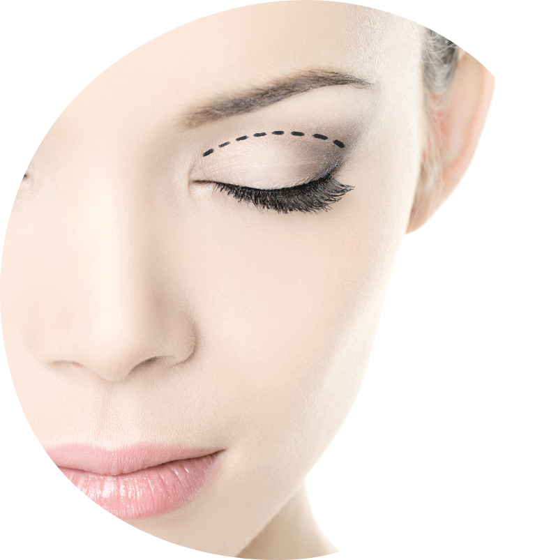 blefaroplastika-rezultati
